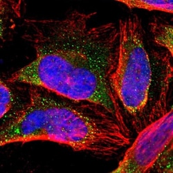 ZNF133 Antibody, Novus Biologicals 25 &mu;L; Unlabeled:Antibodies, Polyclonal